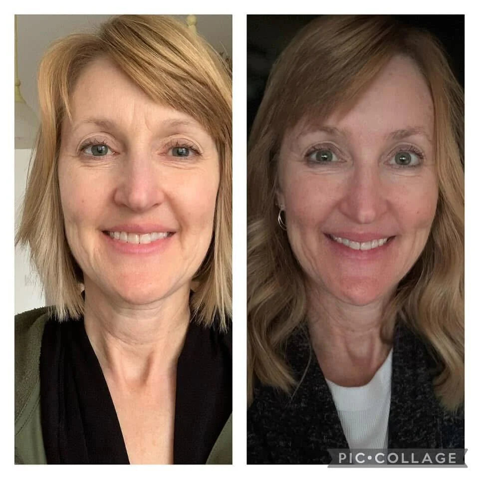 Forehead & between Eyes Facial Patches