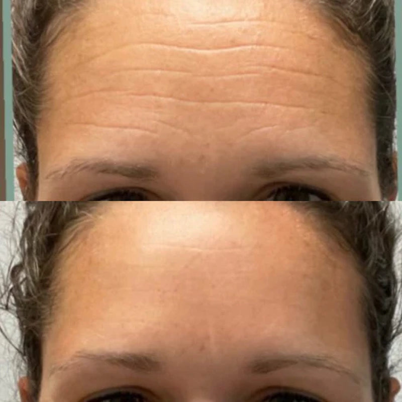 Forehead & between Eyes Facial Patches