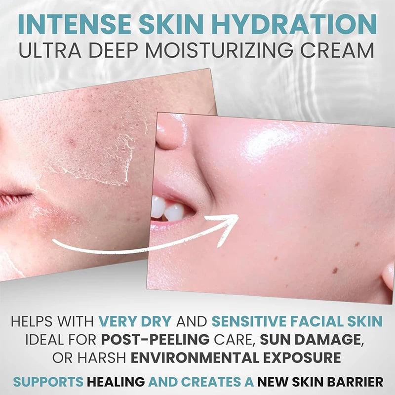 New Hyaluronic Acid Cream Ceramide Promotes Skin Elasticity Luster Nourishing Nourishing Locking Moisture Improve Skin Texture