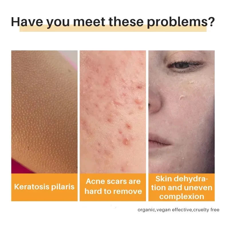 Brightening Bar Kojic Acid Soap Facial Deep Cleaning Even Skin Tone Skin Lightening Soap Oil Control Moisturizing Skin Care 100g