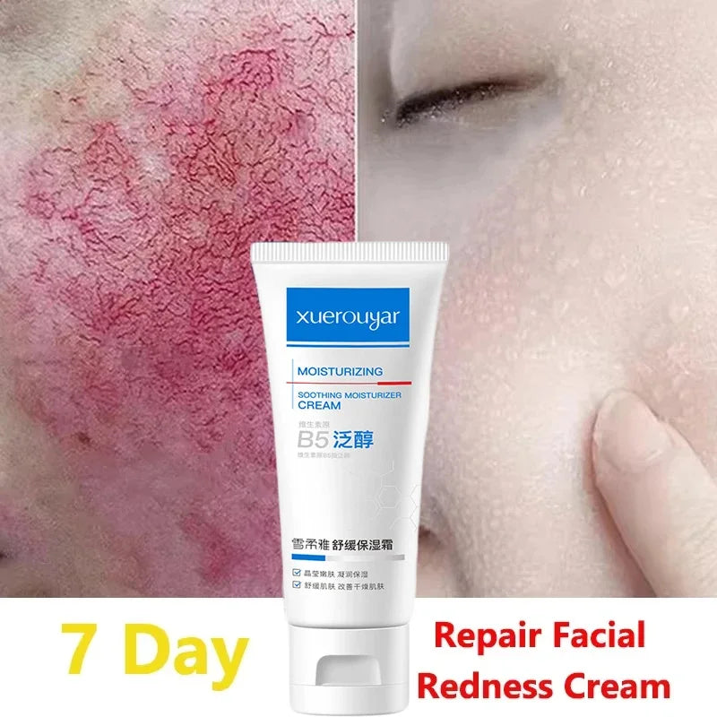 Facial Redness Repair Cream Improve Sensitive Skin Moisturizer Hydrate Sooth Lotion Removal Rosacea Spider Vein Korean Cosmetic