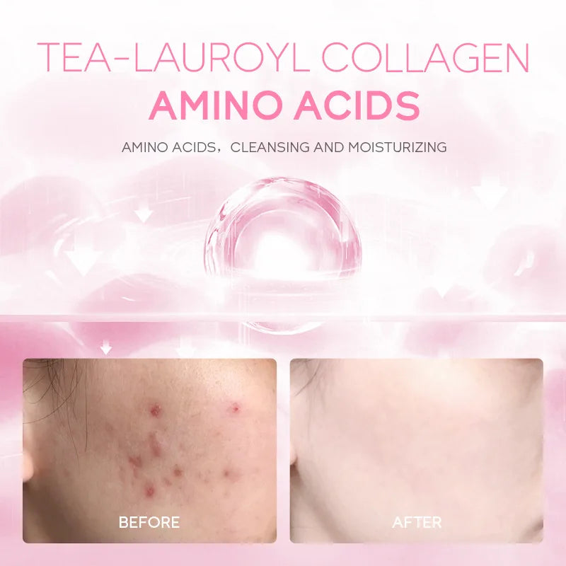 Sakura Facial Cleanser 50g Skin Deep Cleansing Moisturizing Blackhead Removal Skincare Face Wash Foam Face Cleanser Skin Care