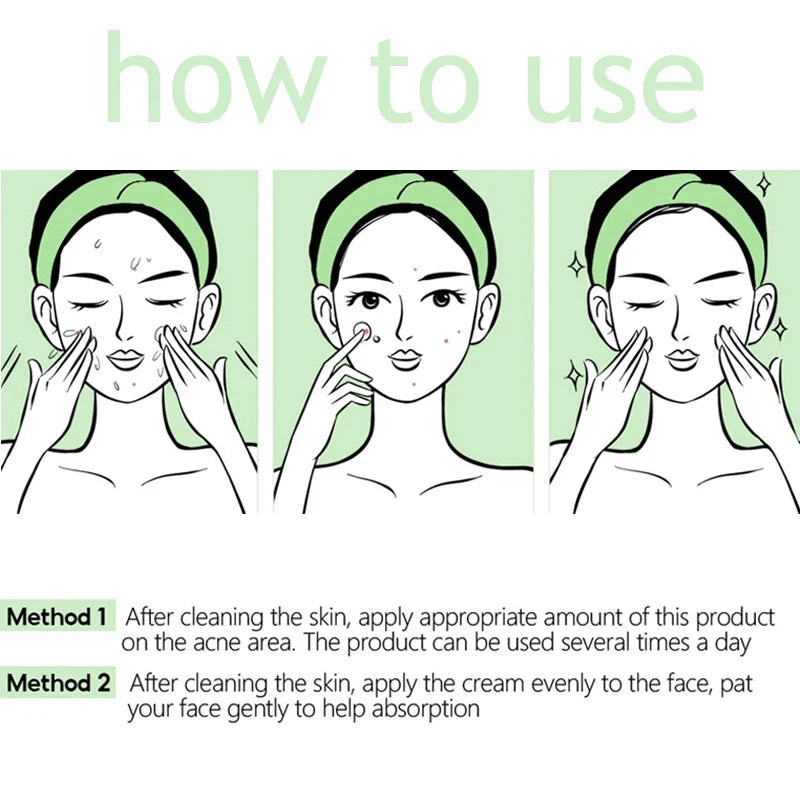 Herbal Acne Removal Face Cream Clears Pimple Scar Black Dots Gel Acne Treatment Shrink Pore Skin Whitening Lightening Ointment