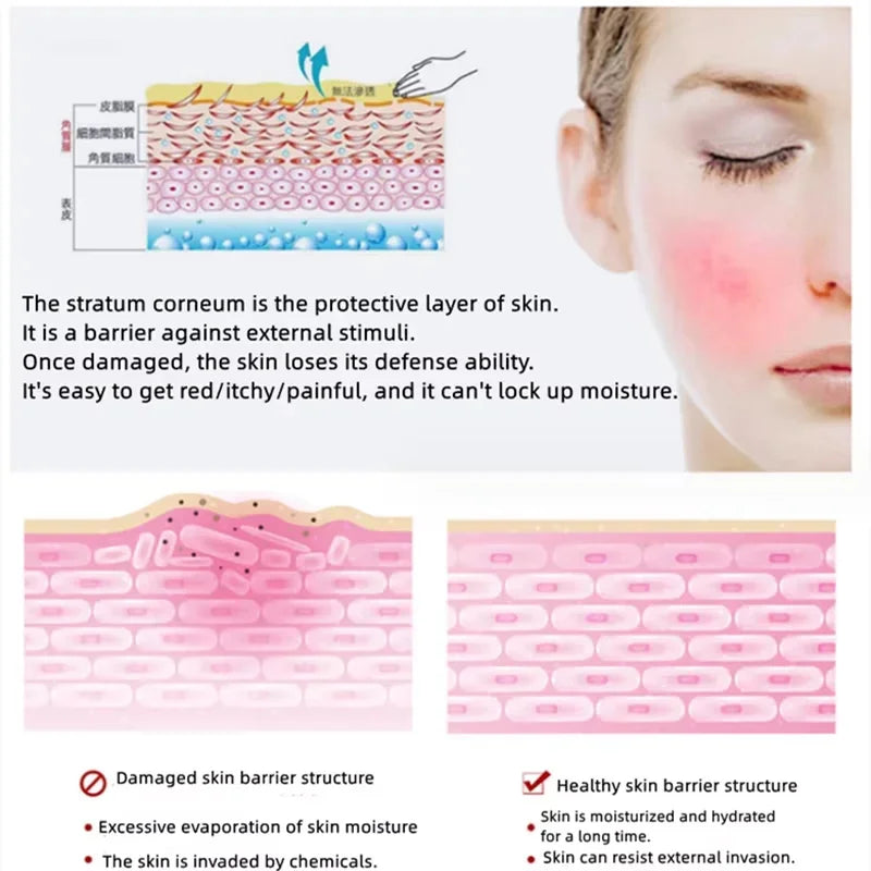 Facial Redness Repair Cream Improve Sensitive Skin Moisturizer Hydrate Sooth Lotion Removal Rosacea Spider Vein Korean Cosmetic