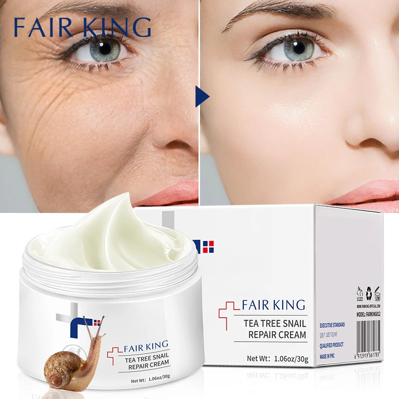 FAIR KING Anti-Wrinkle Moisturizing Face Fine Lines Whitening Cream Snail Sodium Hyaluronate Nourishing Skin Treatment Wrinkle