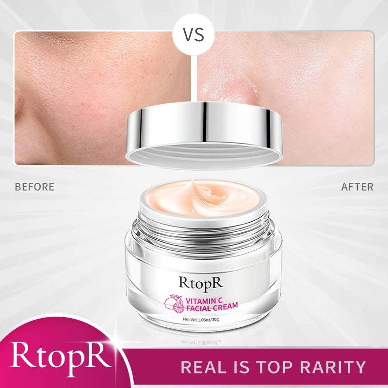 Whitening Face Cream Lightens Fine Lines Moisturizing Anti-aging Anti-wrinkle Nourish Face Care Blemish Cream Vitamin C Extract