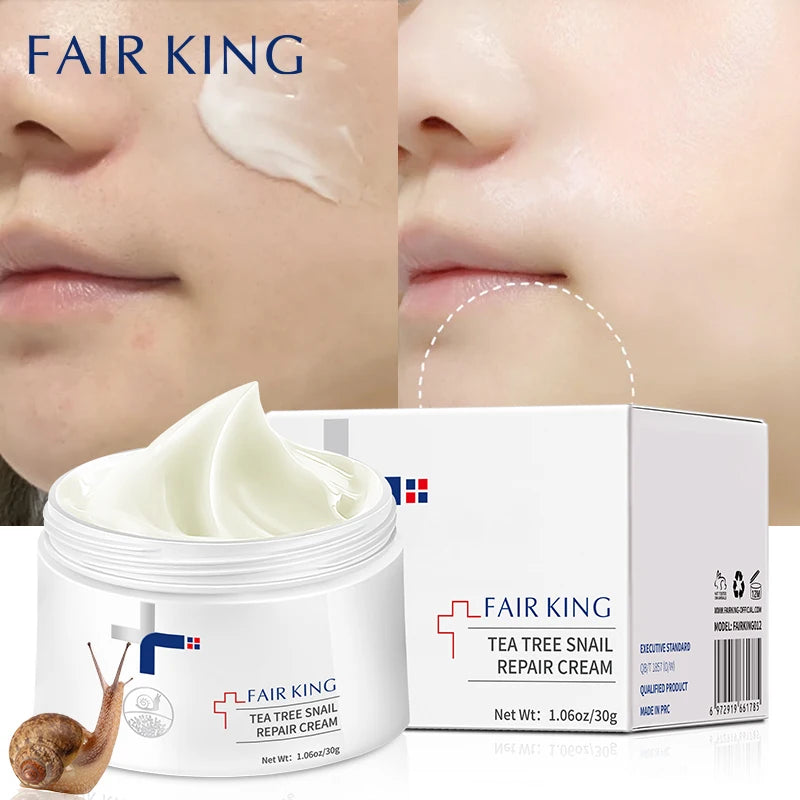 FAIR KING Anti-Wrinkle Moisturizing Face Fine Lines Whitening Cream Snail Sodium Hyaluronate Nourishing Skin Treatment Wrinkle