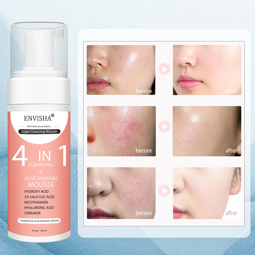 ENVISHA Facial Skin Care Exfoliating Mousse Peeling Gel Deep Remove Cleaning Smooth Moisturizing Cream Whitening Shrinking Pores