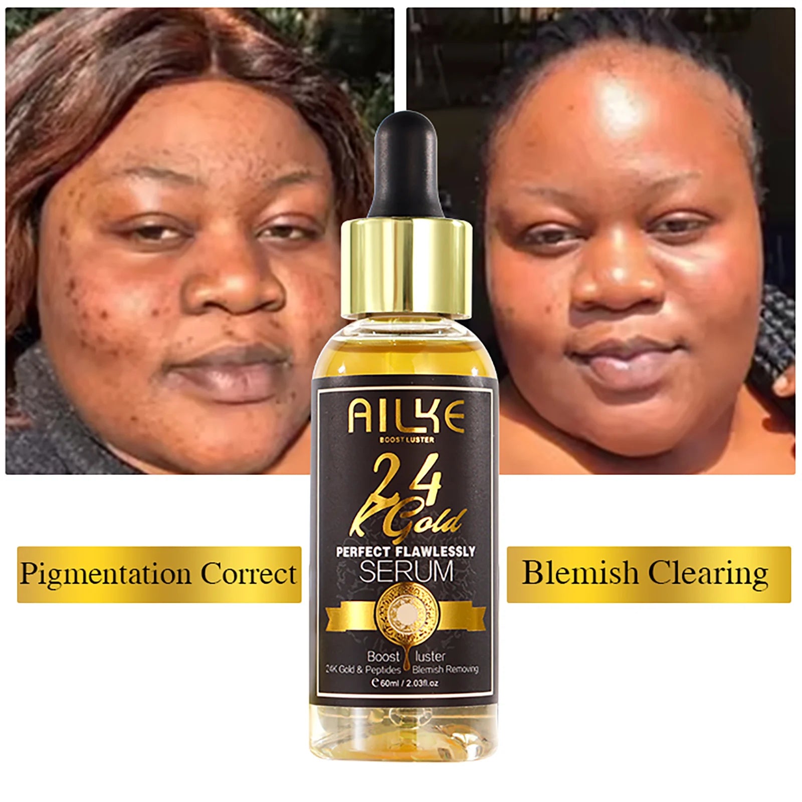 Ailke 24K Gold Collagen Cream Joint Removing Dark Spot Strong Whitening Face Anti Aging Skin Care Set