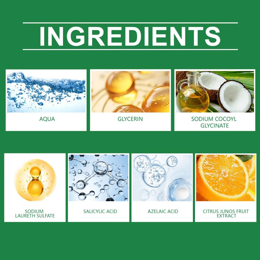 Salicylic acid facial cleanser for acne removal, cleansing, moisturizing, purifying pores, oil control, refreshing skincare