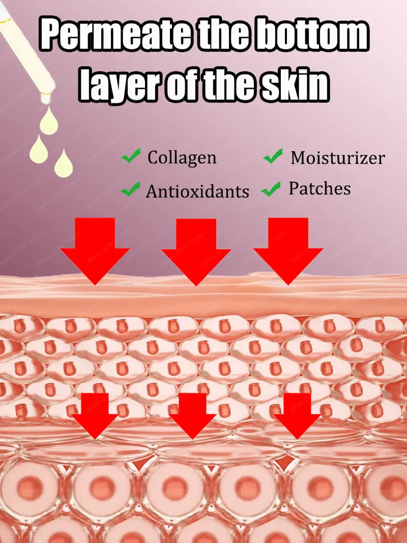 Solve your large pore problem
