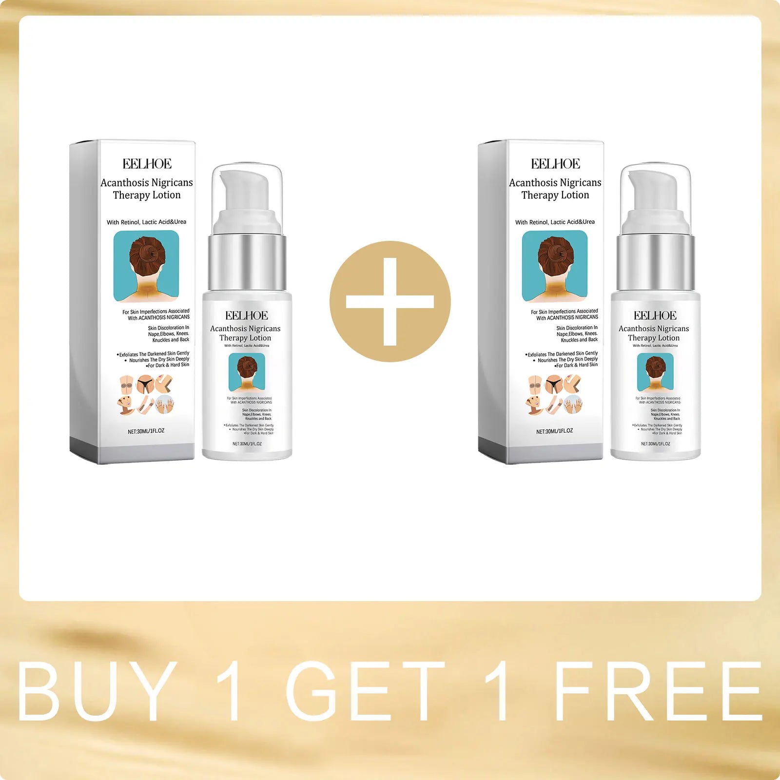 EELHOE Acanthosis Nigricans Therapy Cream Neck Arm Knee Joint Underarm