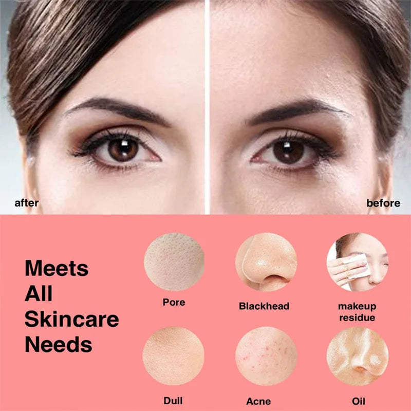 Electric Silicone Pore Cleaner Face Washing Device Household Sonic Facial Cleanser Ultrasonic Vibration Facial Cleansing Brushes