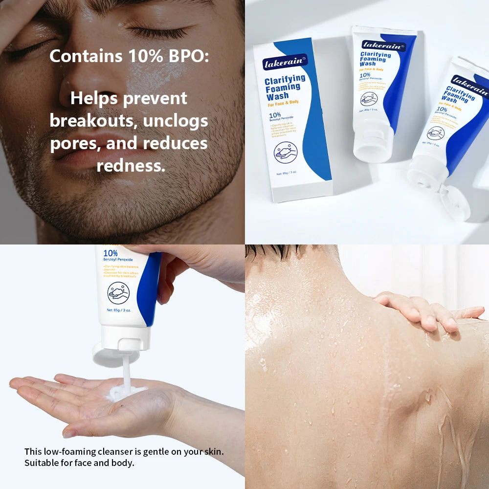 Acne Foaming Wash Benzoyl Peroxide 10% Maximum Antimicrobia Moisturizers reduces redness For Face & Body Skin Care Face Wash