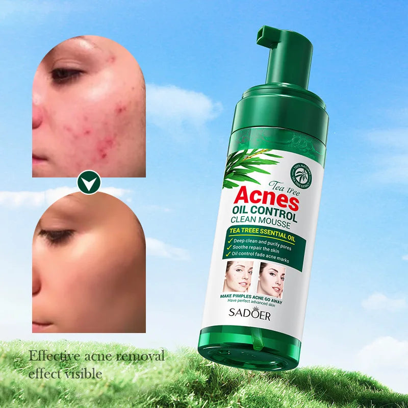 Cleansing Mousse Tea Tree Acne Oil Control