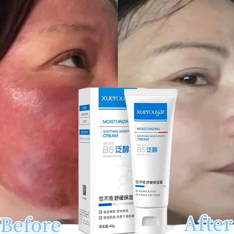 Facial Redness Repair Cream Improve Sensitive Skin Moisturizer Hydrate Sooth Lotion Removal Rosacea Spider Vein Korean Cosmetic