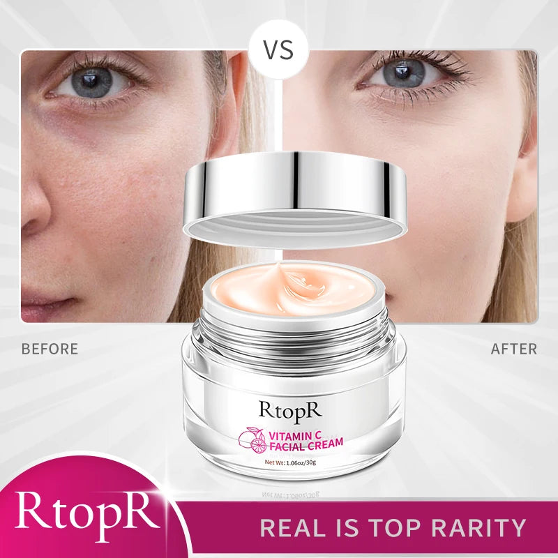 RtopR Vitamin C Facial Cream Whitening Moisturizing Brighting Lighten Melanin Remove Dullness Facial Skin Care Firming Day Cream