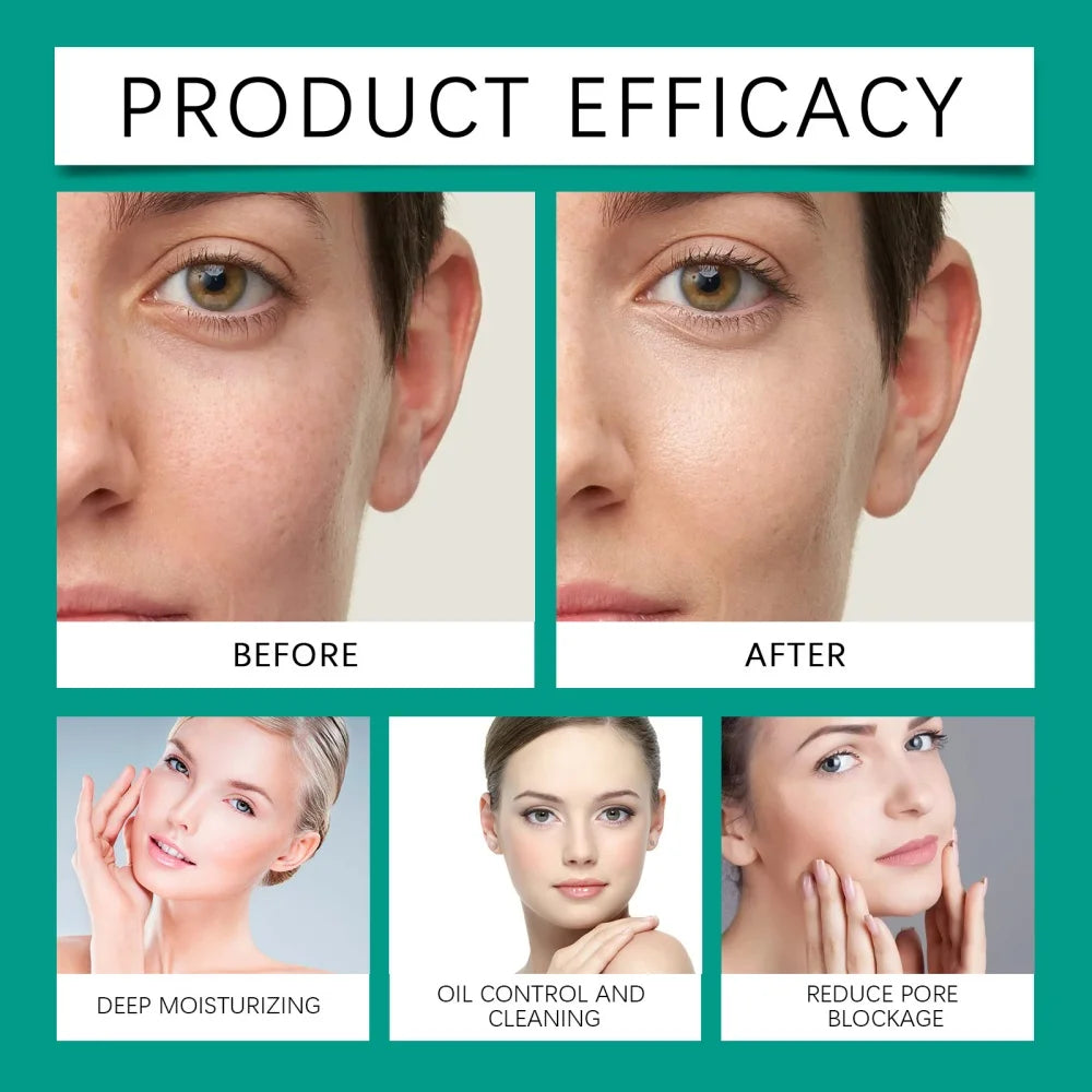 Salicylic acid facial cleanser for acne removal, cleansing, moisturizing, purifying pores, oil control, refreshing skincare