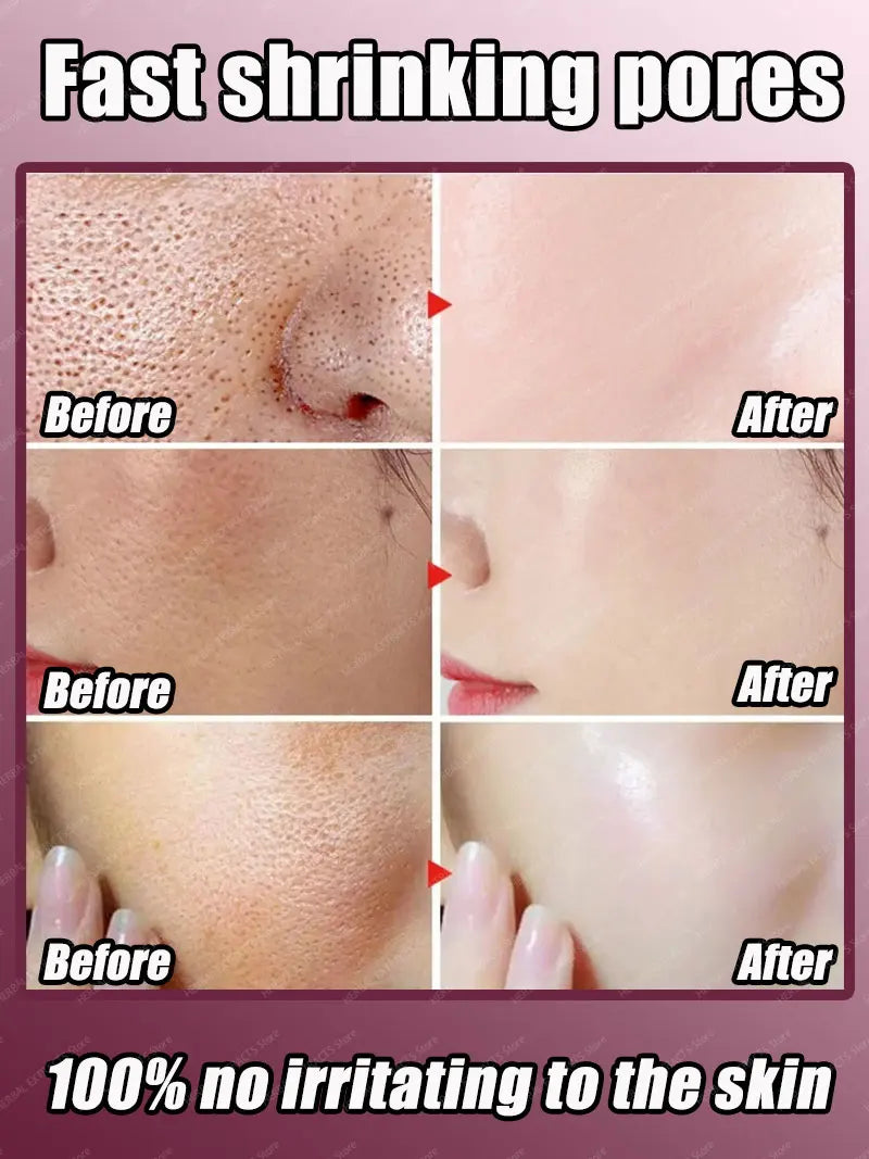 Solve your large pore problem