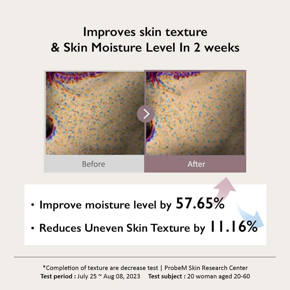 Korean Haruharu Wonder Black Rice Acne Toner and Facial Pore Care