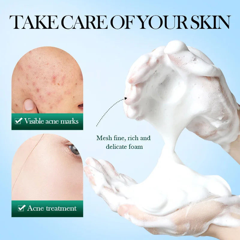 Cleansing Mousse Tea Tree Acne Oil Control