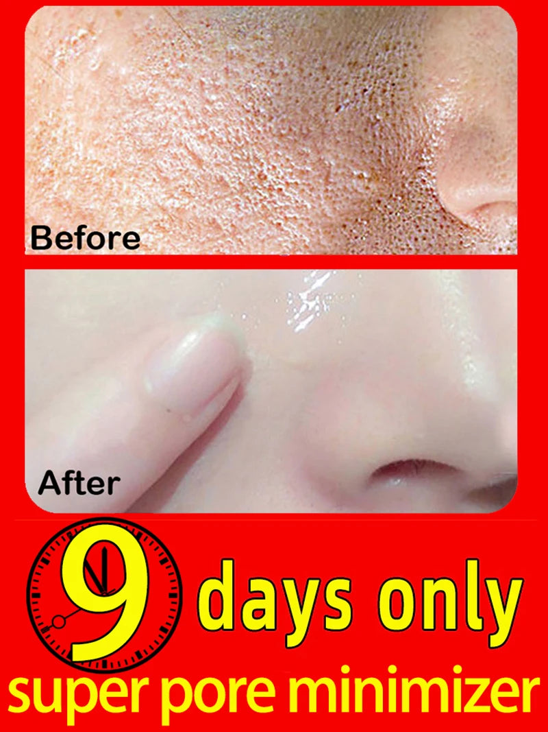 Solve your large pore problem