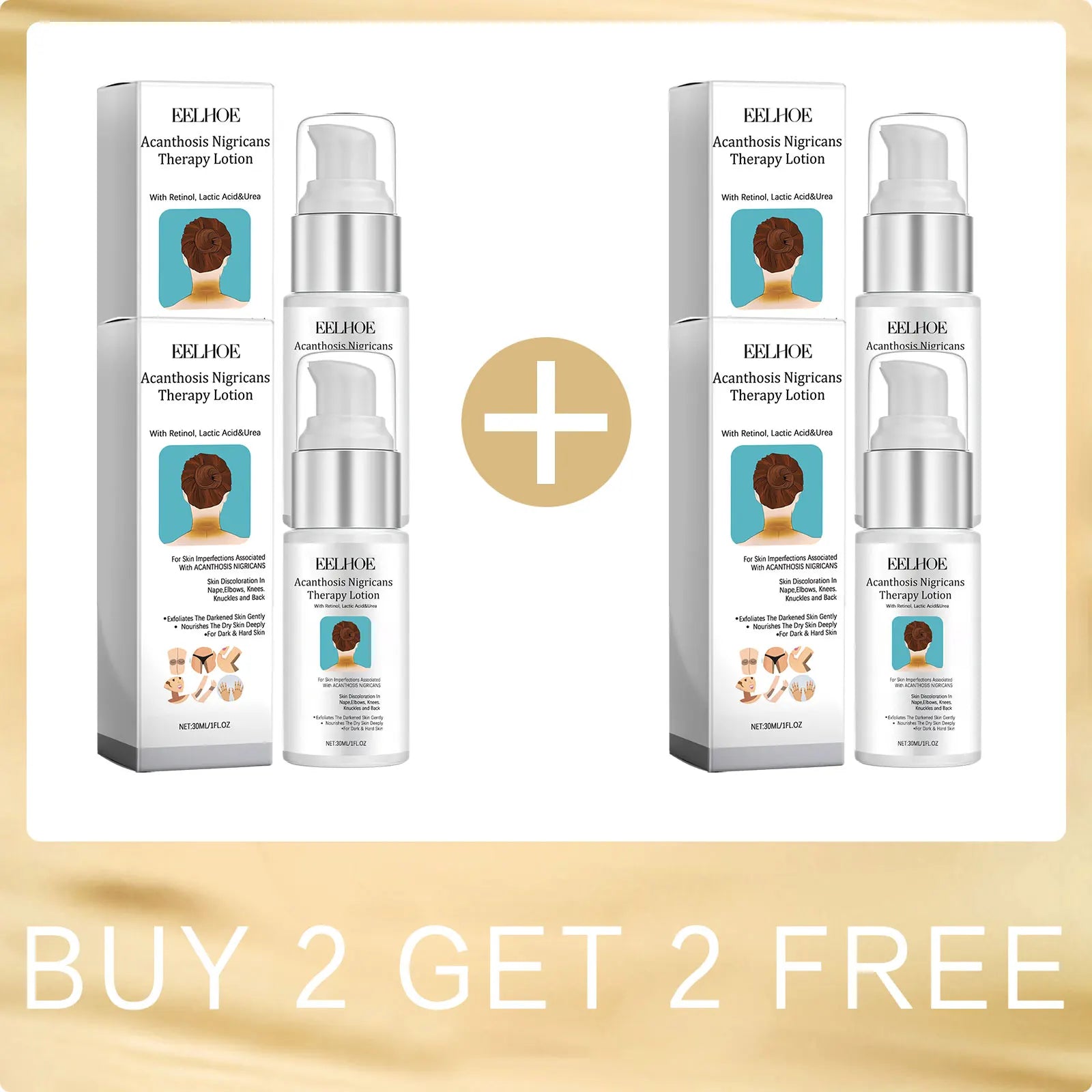 EELHOE Acanthosis Nigricans Therapy Cream Neck Arm Knee Joint Underarm