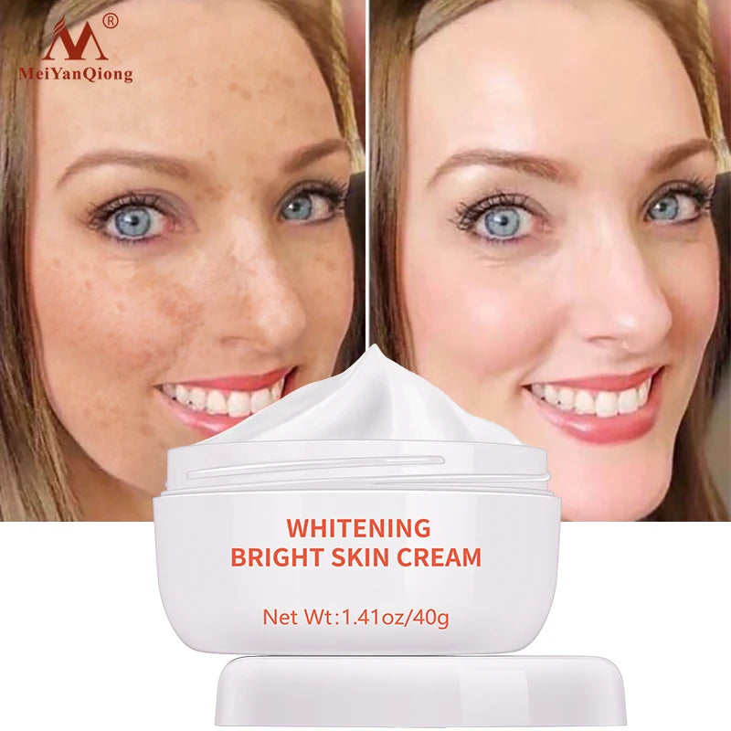 Moisturiser Face Whitening Freckle Cream Remove Acne Spots Melanin Dark Spots Face Lift Firming Face Skin Care Bright Skin Cream