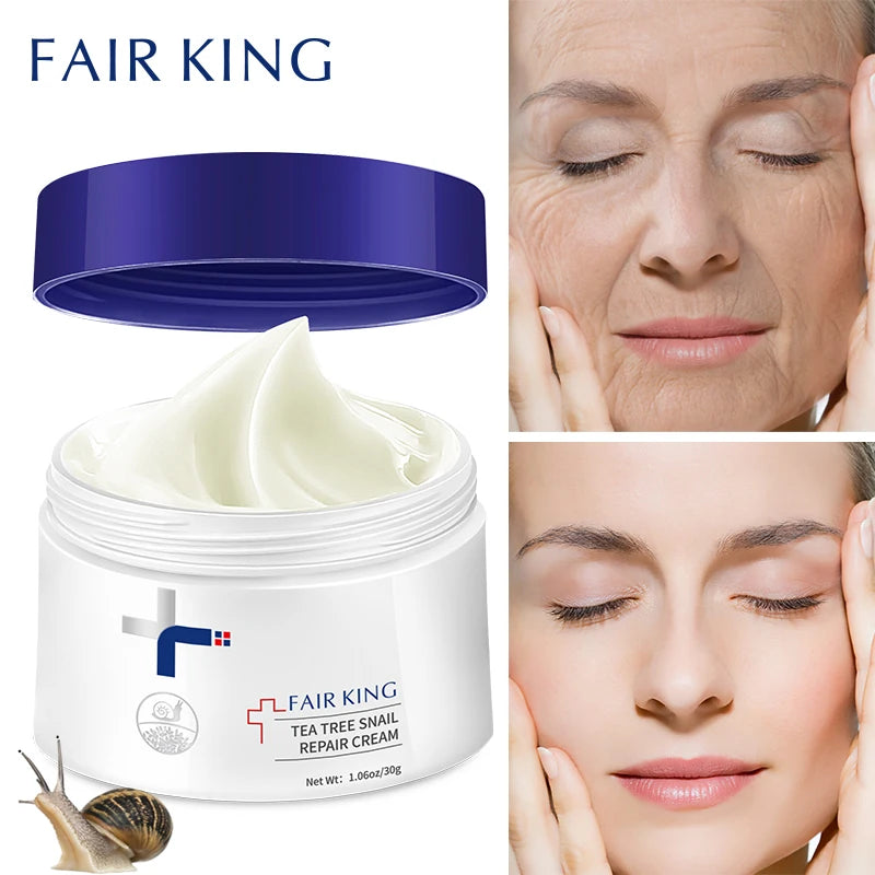 FAIR KING Anti-Wrinkle Moisturizing Face Fine Lines Whitening Cream Snail Sodium Hyaluronate Nourishing Skin Treatment Wrinkle