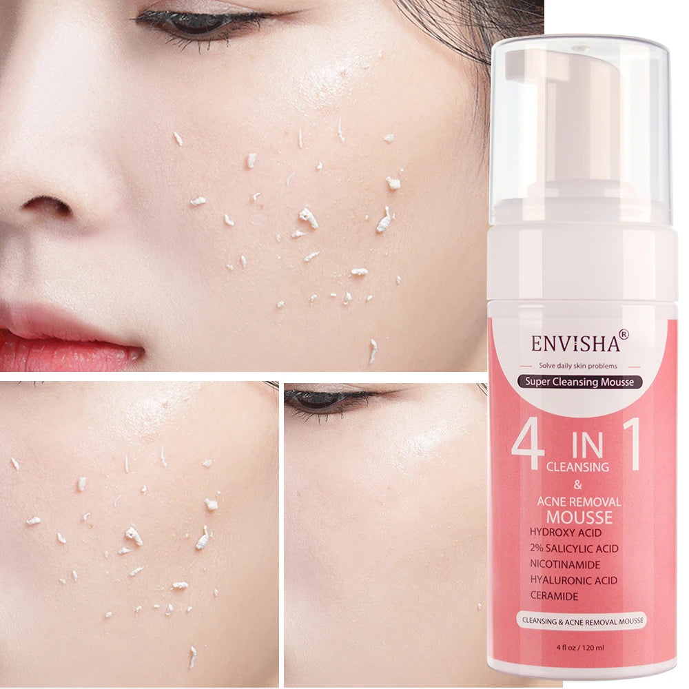 ENVISHA Facial Skin Care Exfoliating Mousse Peeling Gel Deep Remove Cleaning Smooth Moisturizing Cream Whitening Shrinking Pores