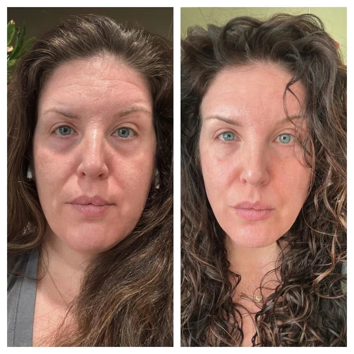 Forehead & between Eyes Facial Patches