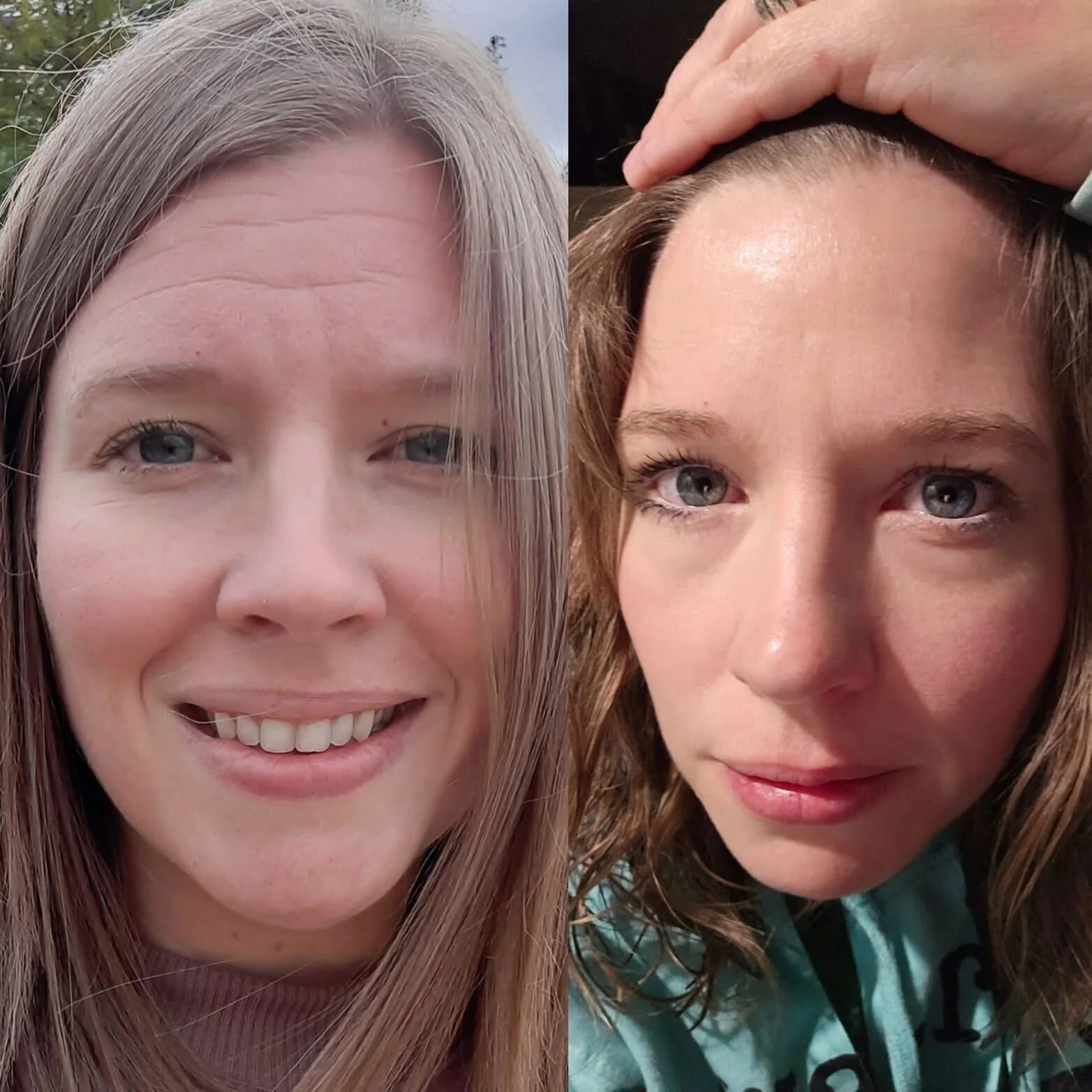 Forehead & between Eyes Facial Patches