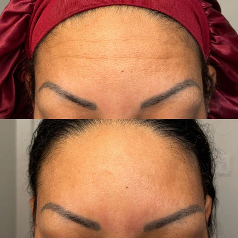 Forehead & between Eyes Facial Patches